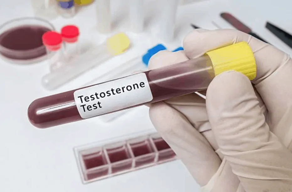 comment connaitre son taux de testostérone
