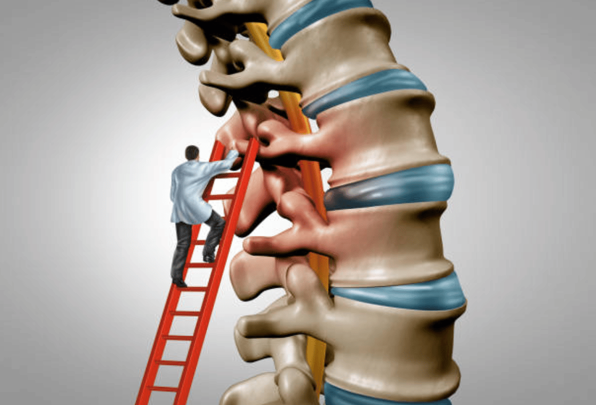 musculation apres hernie discale