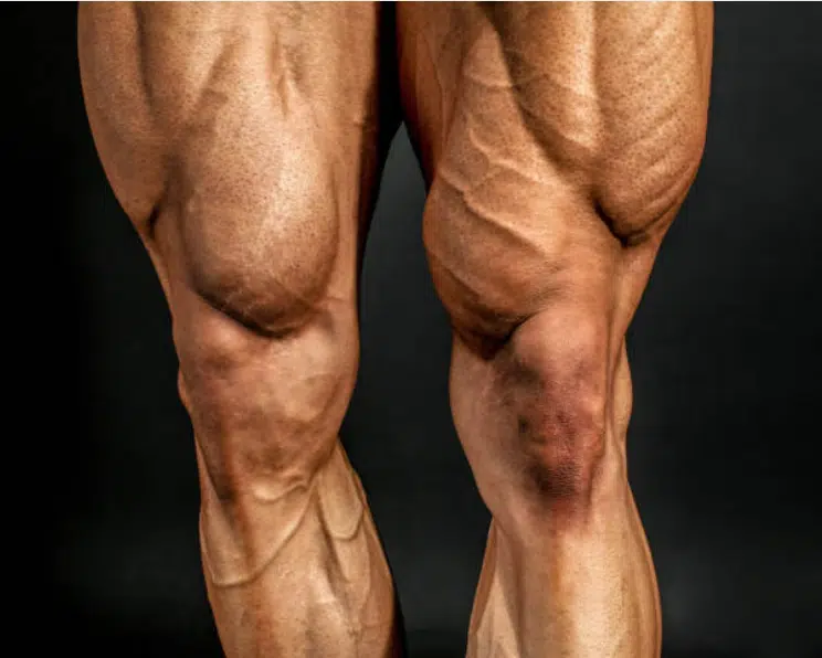 4 bonnes raisons pour se muscler les jambes
