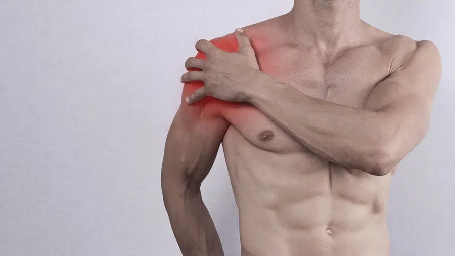 A shirtless man holds his shoulder because he has a rotator cuff injury.