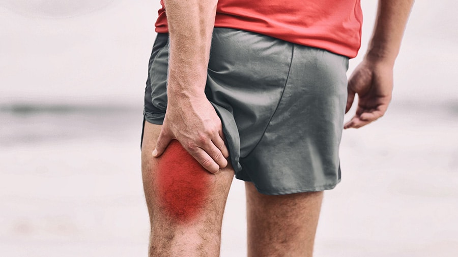 Un sportif en short se tient l'arrière de la cuisse gauche suite à une blessure telle qu'une élongation musculaire.