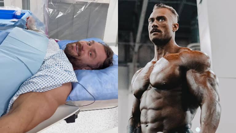 Chris Bumstead: why did he resort to stem cell therapy?