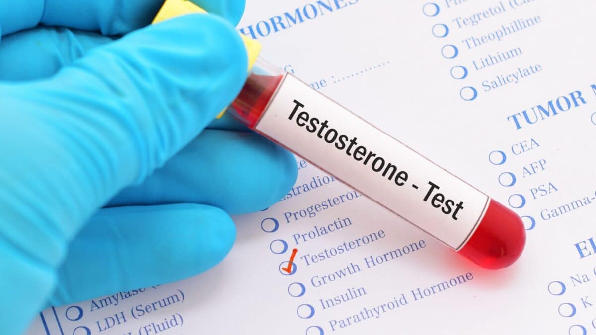 A gloved doctor holds a testosterone blood sample in one hand, in front of a document on which the word "Testosterone" is marked.